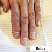 トラブルネイル