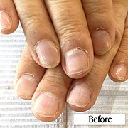 弱い爪（欠ける・折れる）