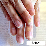 トラブルネイル